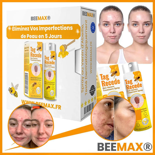 Éliminez Vos Imperfections de Peau en 5 Jours - Spray au Venin d'Abeille, Naturel et Efficace, Testé Dermatologiquement